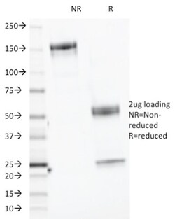 Elastase Antibody (CELA3B/1218), Novus Biologicals 0.2mg; Unlabeled:Antibodies,